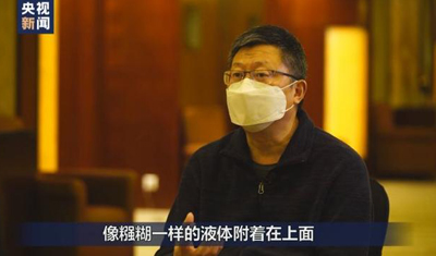 首例新冠肺炎尸检报告发布:肺已经不是肺了!