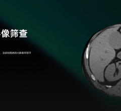 达医智影